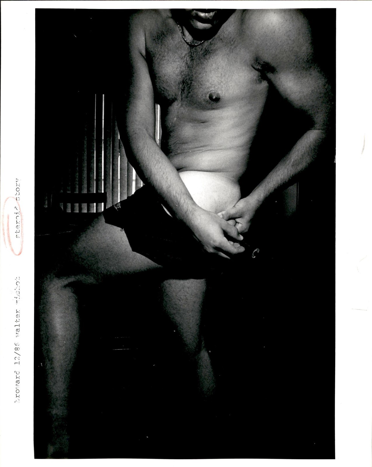 LD418 1986 Original Photo ATHLETE USING PERFORMANCE ENHANCING DRUGS STEROIDS