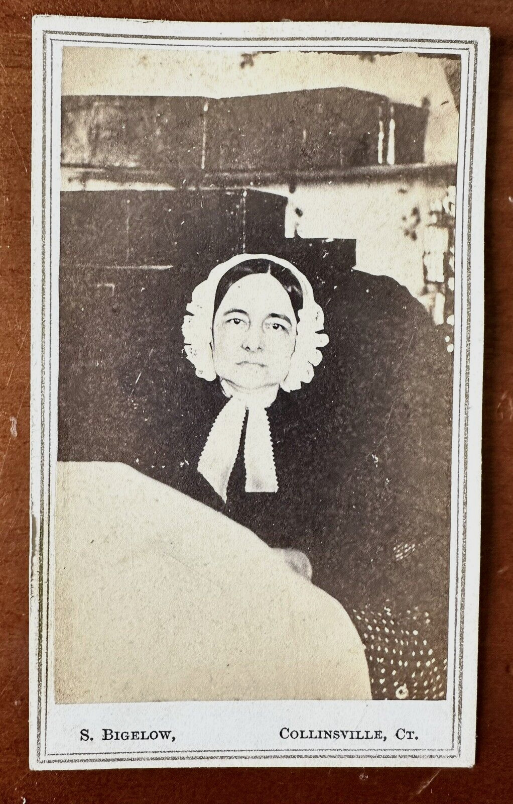 Chloe Lankton Disabled Woman 1860s CDV Photo Medical Not Post Mortem Unusual