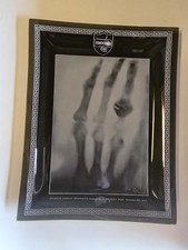 VTG Philadelphia X-ray Wilhelm Conrad Rontgen Radiograph Wife's Hand Glass Tray picture