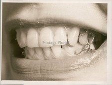 1975 Dieters Jaws Wired Shut Dental Braces January Historic Vintage Photo 7x9 picture