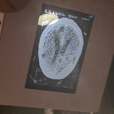 Vtg Medical 35mm Slide Lot w/ Box - 140 Human Brain CT Scans Oddities Archive picture