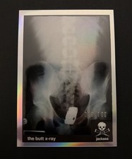 2022 ZEROCOOL JACKASS CARD STUNTS #s-3 THE BUTT X-RAY SILVER HOLO /100 RYAN DUNN picture