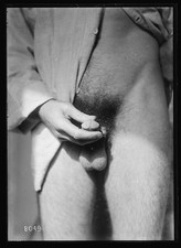 Photo:Bellevue New York NY 1918 Gas Burns Skin Disease Medical Treatment picture